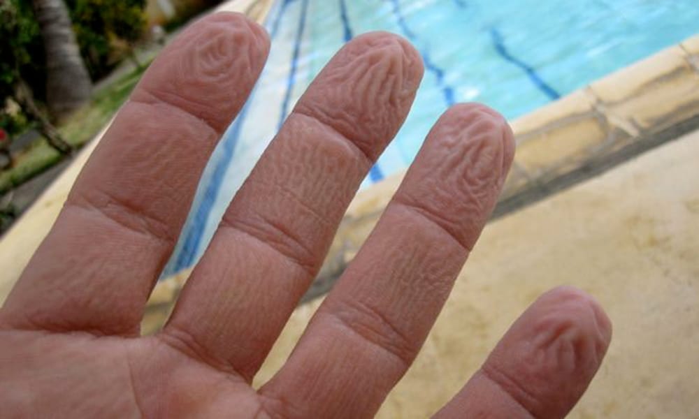 το ζάρωμα των δαχτύλων είναι μια εξαιρετικά πολύπλοκη βιολογική λειτουργία,